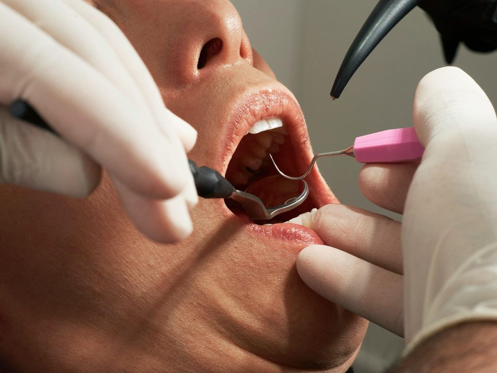Patient undergoing a dental examination with a mouth mirror and pick during a checkup